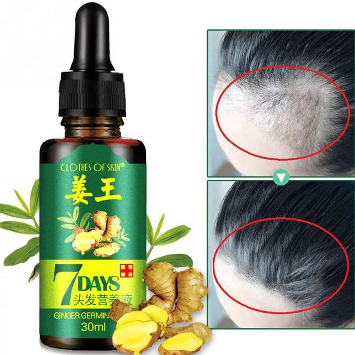 BowLift | Hair Regrow Oil | 7 Day Hair Regrowth Ginger Serum