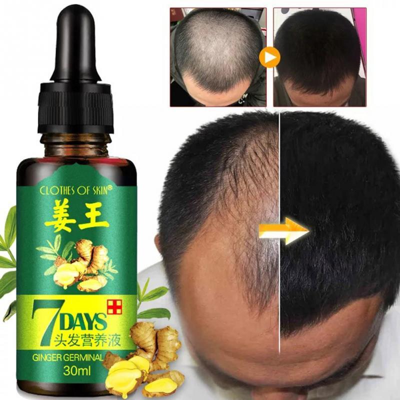 BowLift | Hair Regrow Oil | 7 Day Hair Regrowth Ginger Serum