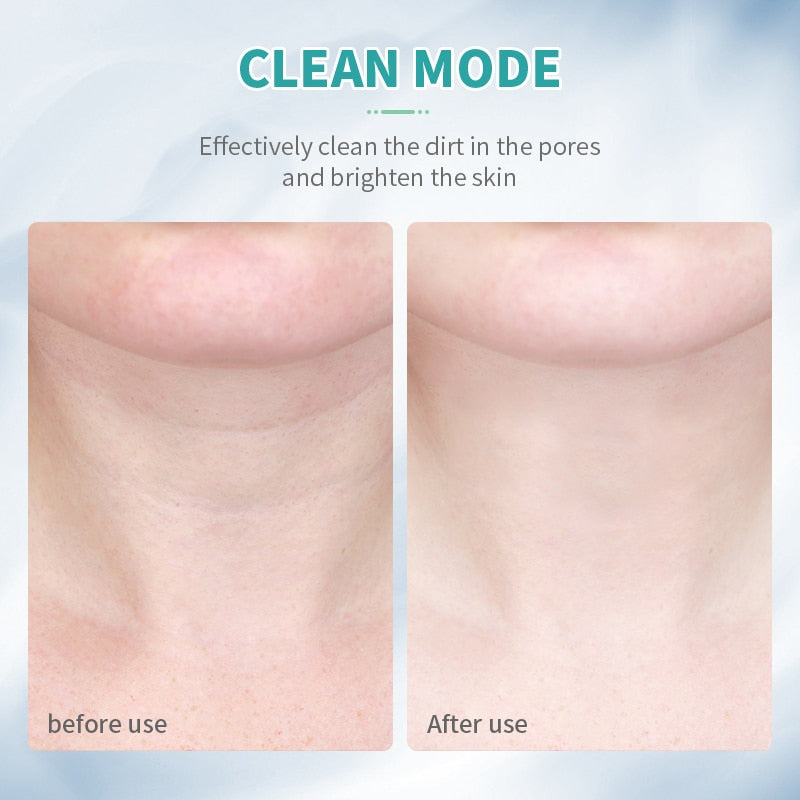 BowLift | Beauty Skin Device