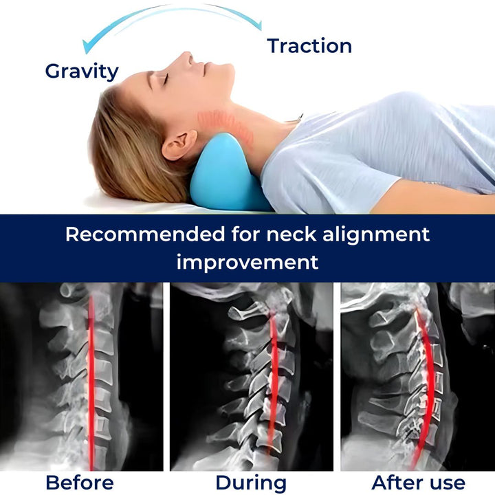 NeckAlign Chiropractic Neck Pillow | Stretcher for Neck - Pain Relief - Improved Posture - Better Sleep Bowlift