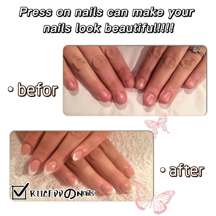 Artificial nail set with elegant French design and trendy accents Bowlift