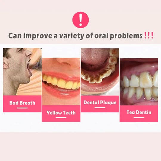 BowLift | Ultrasound Tooth Cleaner for Deep Cleaning & Radiant Smile
