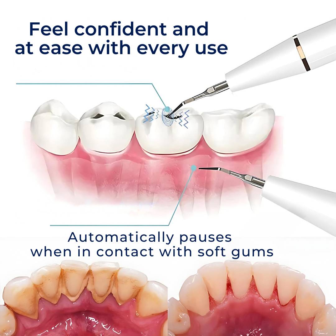 PlaqueFree Plaque Remover for teeth | Ultrasonic Teeth Cleaner - Tartar Remover from Home - Deep Teeth Cleaning and Polish Bowlift