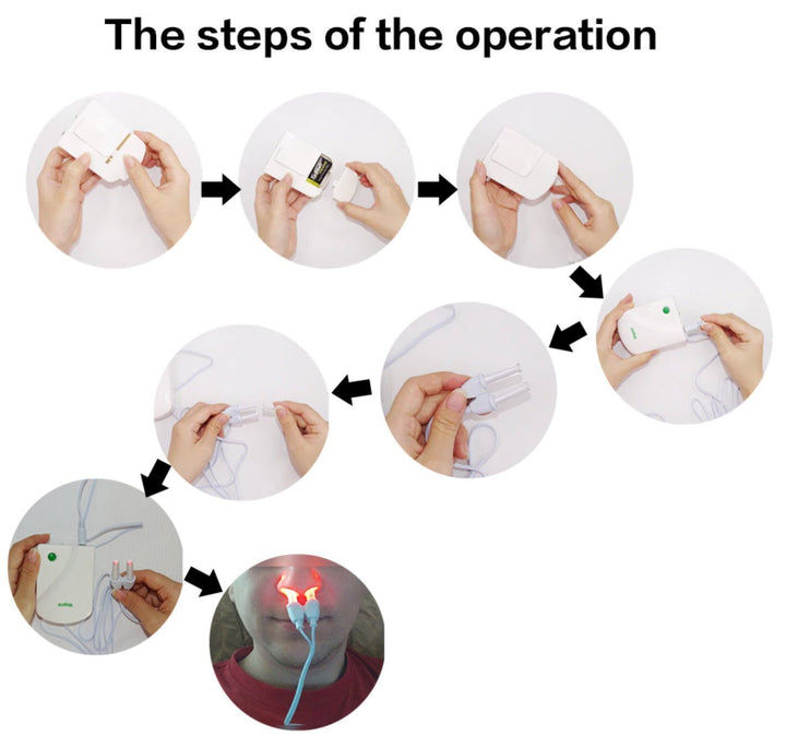 BowLift | Infrared Rhinitis Therapy Device