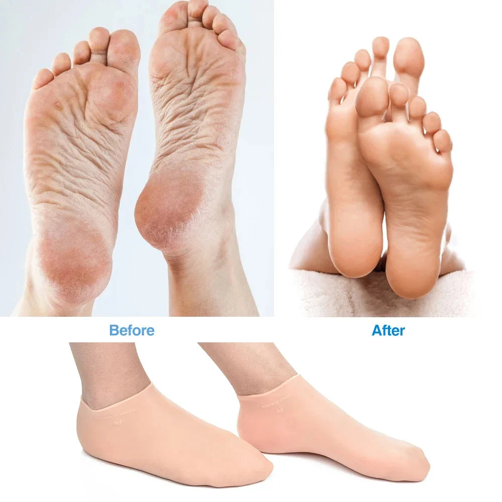 BowLift | Silicone Wetsuit Beach Socks