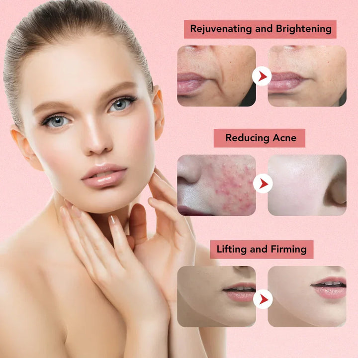 BowLift | Aetheris™ | Ultrasonic Skin Lifting Tool | Facial Sculpting Device for Anti-Aging & Skin Tightening