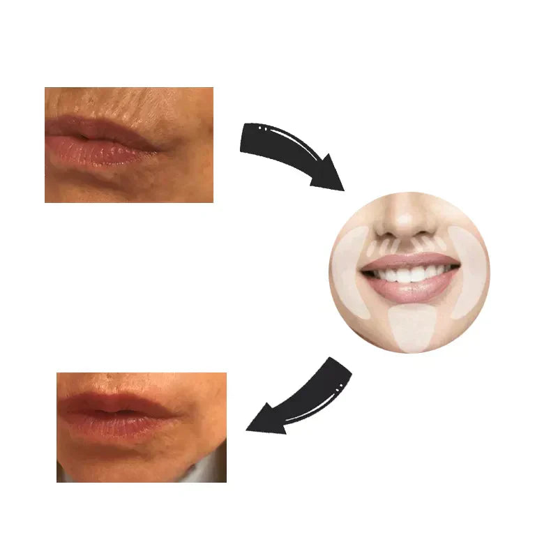 BowLift | Face Lift Reusable Tape