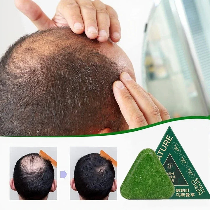 BowLift | Herbal Anti-Hair Loss Shampoo Bar