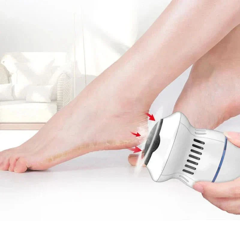 BowLift | Rechargeable Electric Callus Remover with Vacuum