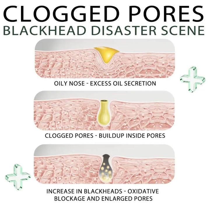 BowLift | Black Tea Facial Peel off Mask