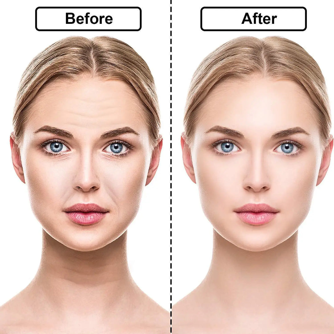 BowLift | Reusable Anti Wrinkle Silicone Sticker 16 Pcs