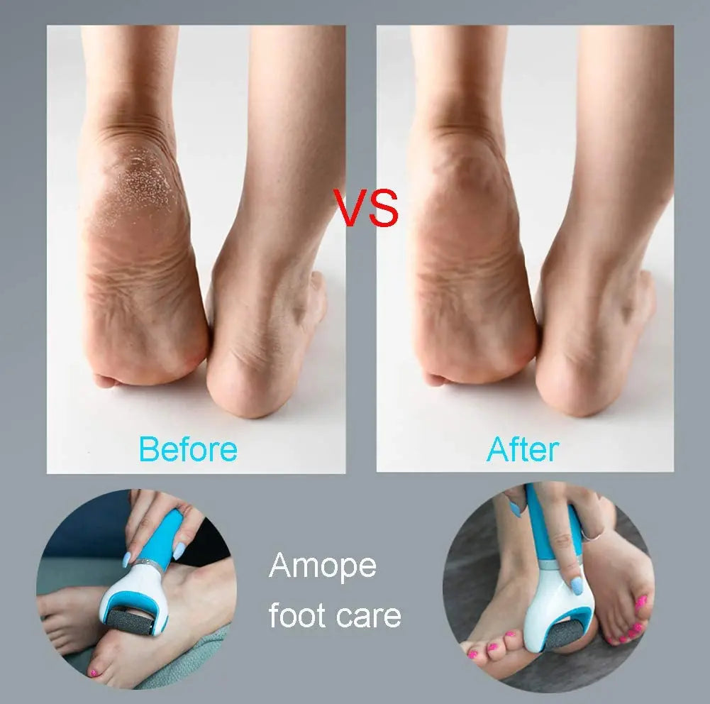 BowLift | USB Foot Callus Remover Pedicure Tool