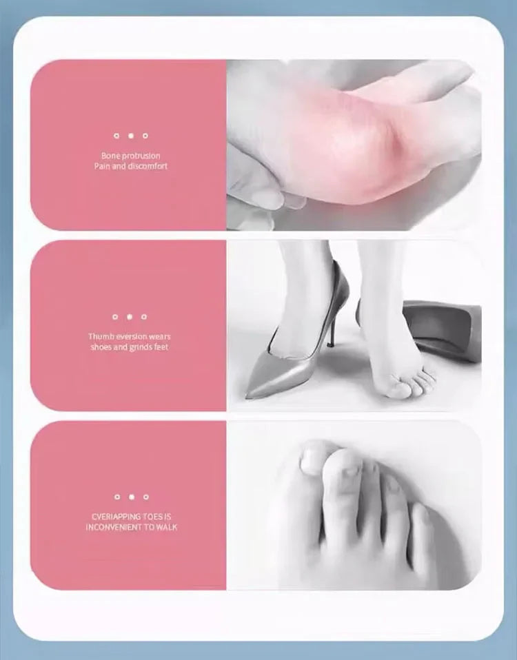 BowLift | Silicone Hallux Valgus Bunion Corrector