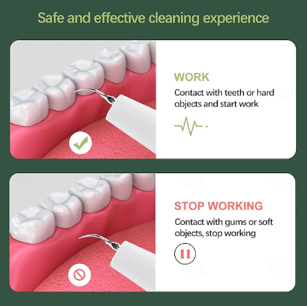 BowLift | Dental Scaler | Ultrasonic Plaque Remover Tool for Home
