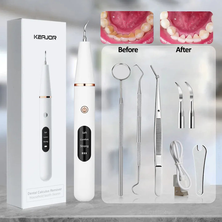 BowLift | Electric Dental Calculus Remover