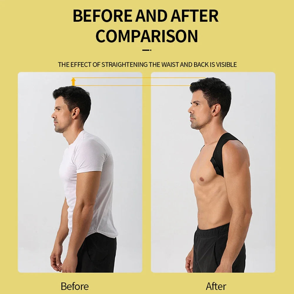 BowLift | Adjustable Neck And Shoulder Posture Corrector