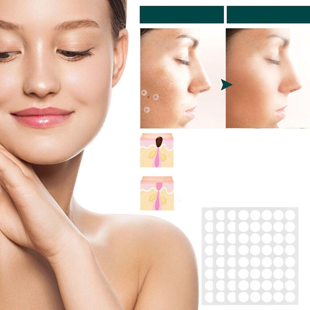 BowLift | SkinClear - Plaster for the removal of spots and warts