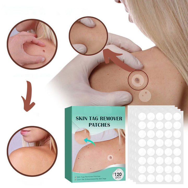 BowLift | SkinClear - Plaster for the removal of spots and warts