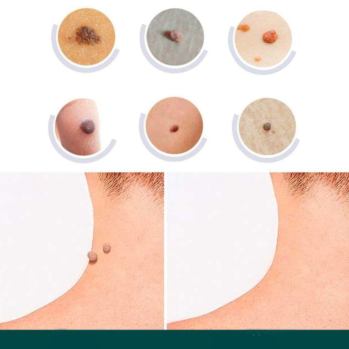 BowLift | SkinClear - Plaster for the removal of spots and warts