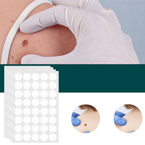 BowLift | SkinClear - Plaster for the removal of spots and warts