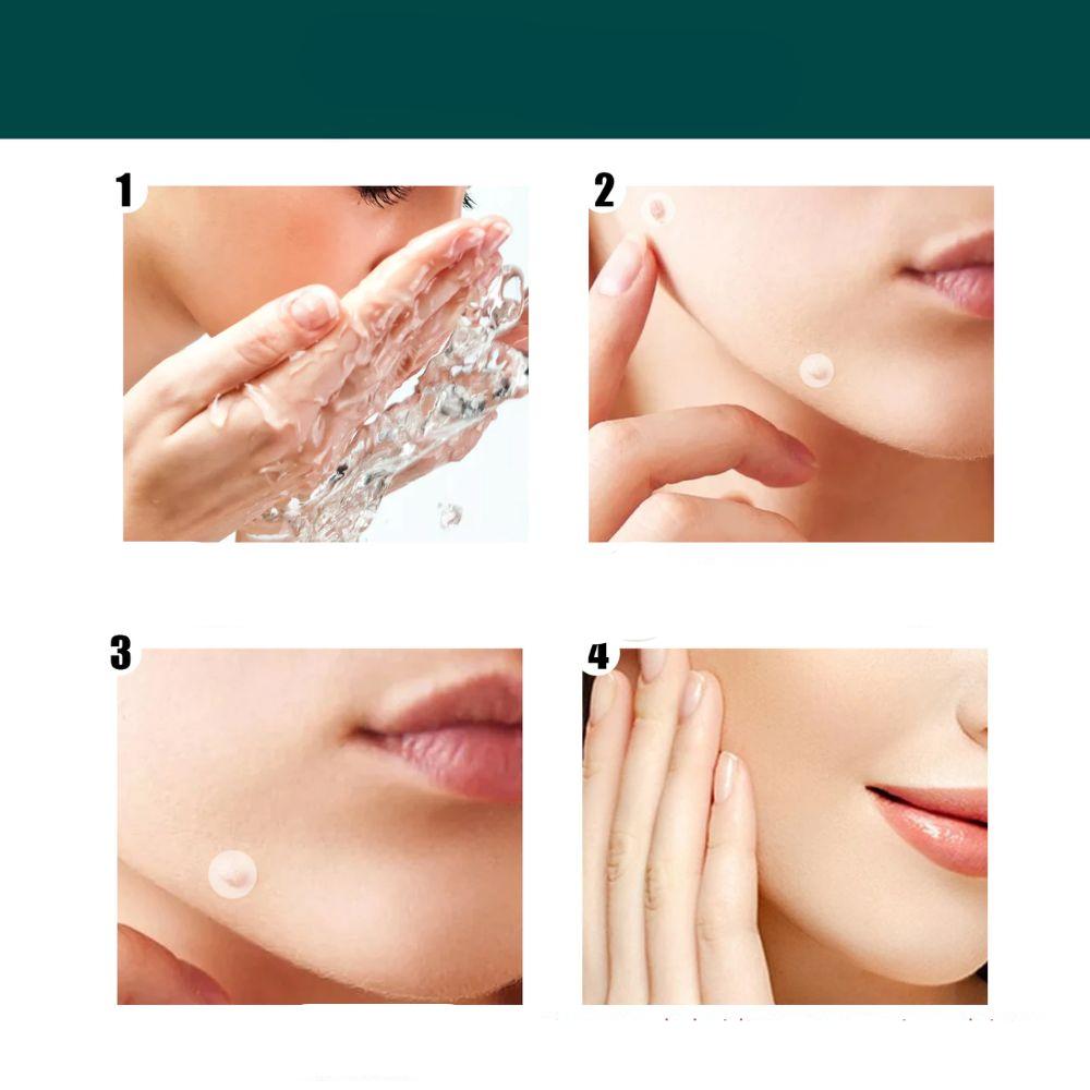 BowLift | SkinClear - Plaster for the removal of spots and warts