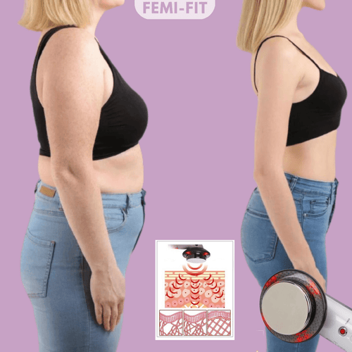 BowLift | SlimShape – 3-in-1 Cellulite & Fat Burner with EMS, Ultrasound & Infrared Light