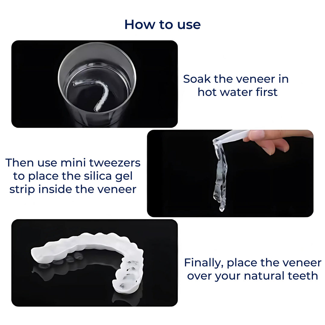 SmileEase | Clip-On Veneers – Instant Smile Enhancement – Ultra-Thin Design – Ideal for Adults Seeking Affordable Dental Solutions Bowlift