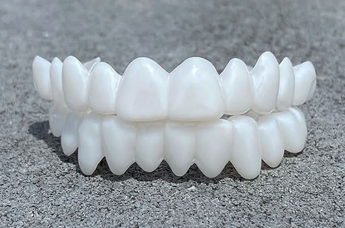 BowLift | Customizable Dental Prosthesis with Dental Lenses