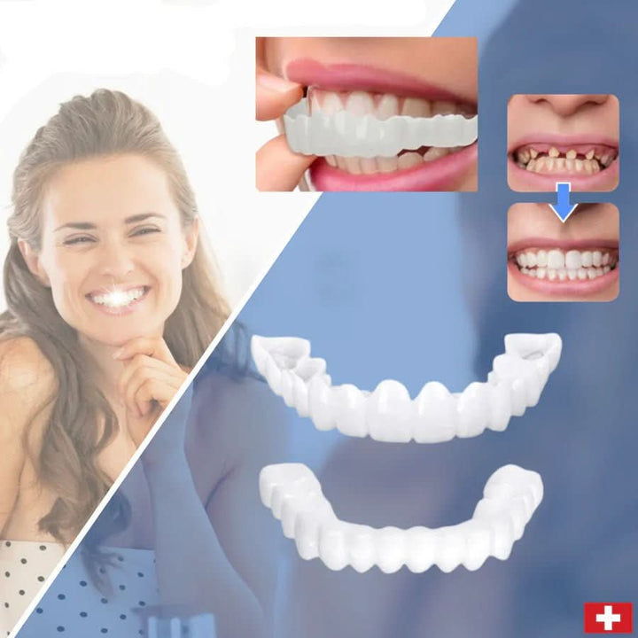 BowLift | tooth restoration for a perfect smile without a visit to the dentist