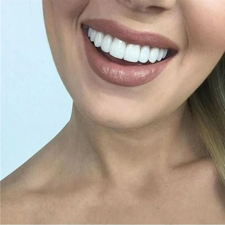 BowLift | tooth restoration for a perfect smile without a visit to the dentist