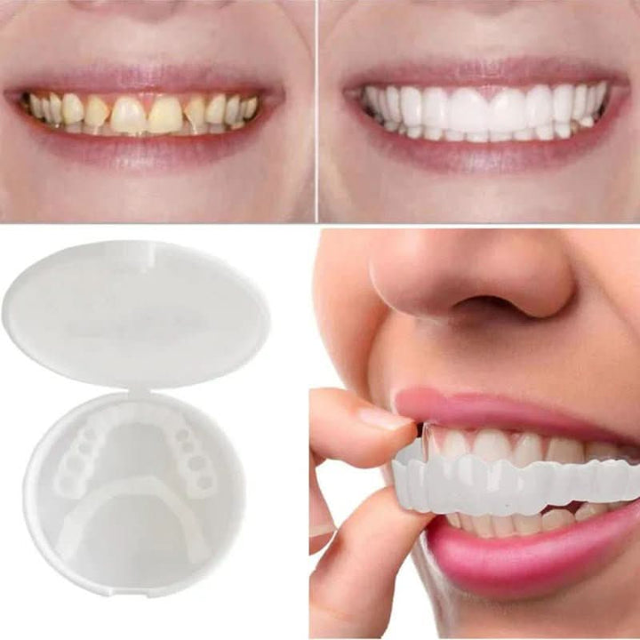 BowLift | tooth restoration for a perfect smile without a visit to the dentist