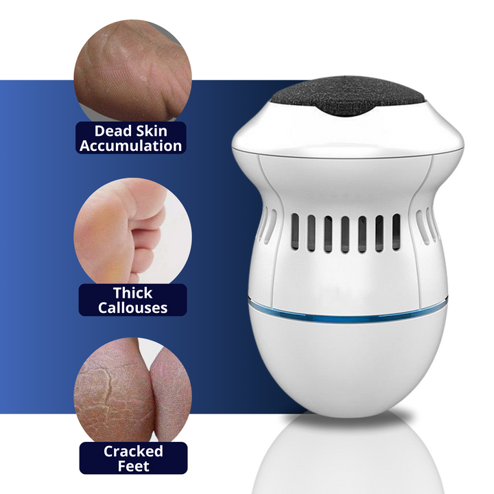 Electric Foot Care Professional | No More Calluses! | Bowlift
