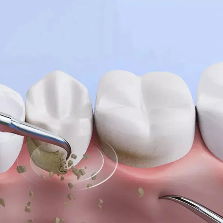 BowLift | Ultrasonic Tooth Cleaning Pro – Electric Tartar Remover for Home Use