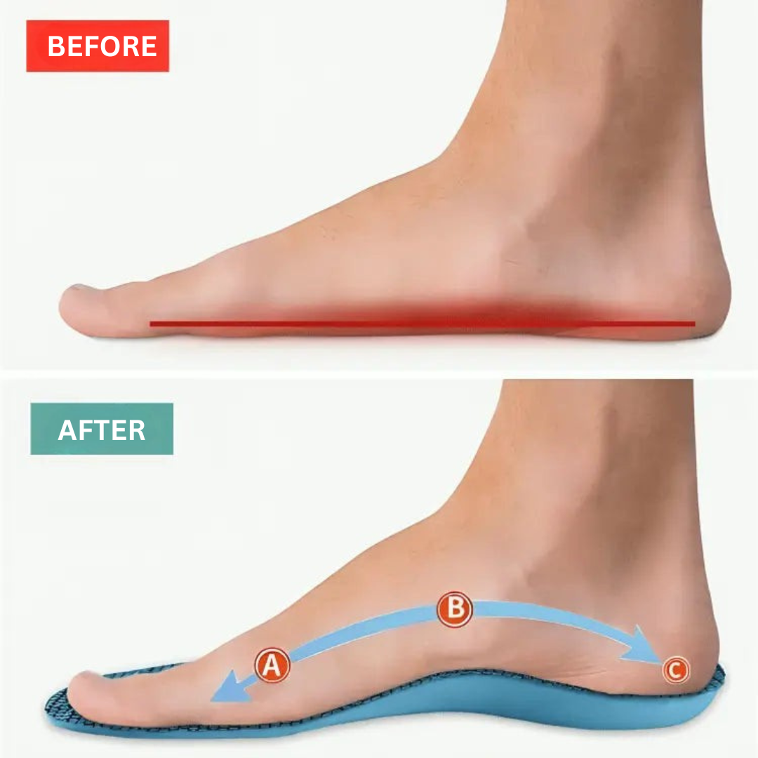 BowLift | Shoe Insoles with Gel Support for Comfort