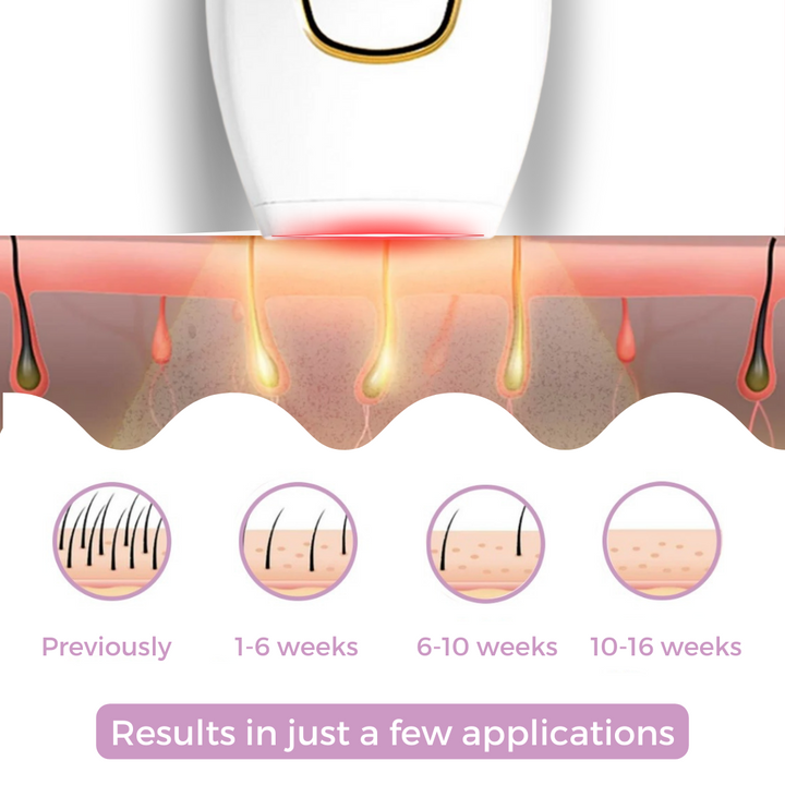 BowLift | SmoothWave™ IPL Hair Remover