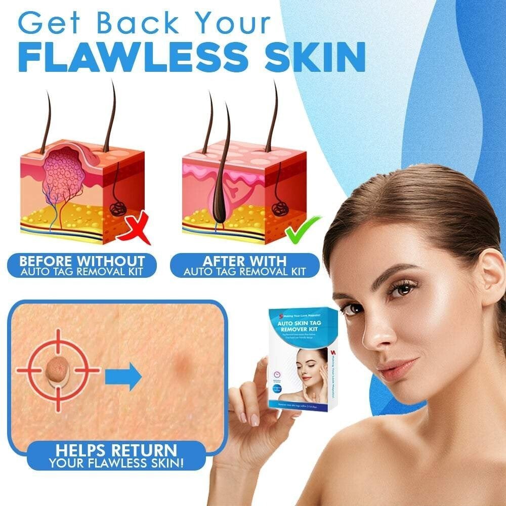 BowLift | SmoothZap — Pain-free skin freedom for a new sense of confidence in just 10 days