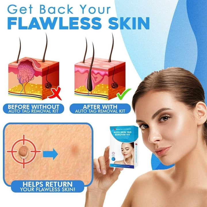 BowLift | SmoothZap — Pain-free skin freedom for a new sense of confidence in just 10 days