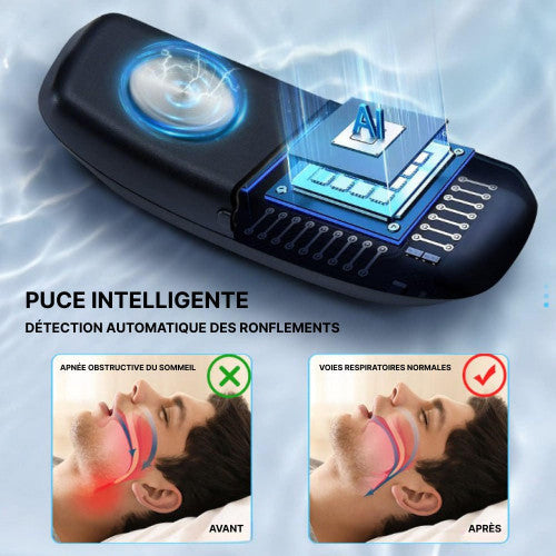 BowLift | Comfortable and Effective Anti-Snore Device