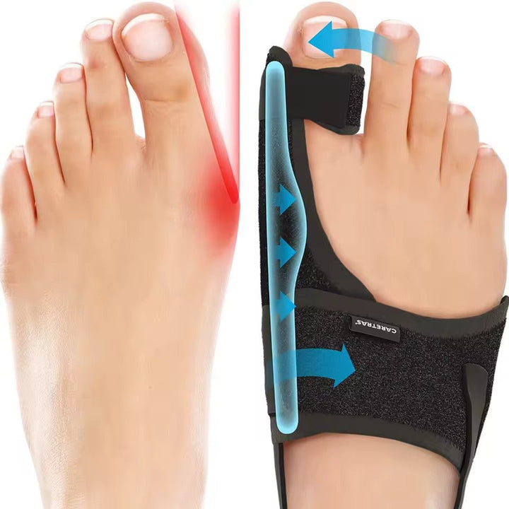 BowLift | Night Splint Hallux Valgus - Ergonomic and Adjustable Comfort
