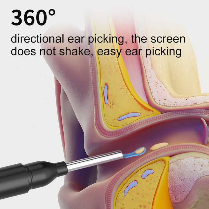 BowLift | AURIVIEW – Smart Ear Cleaner with HD Camera