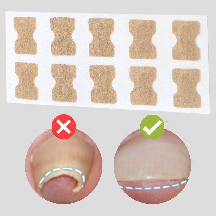 BowLift | ProFlexiPatches — Pain-free natural nails that you show off again with pride