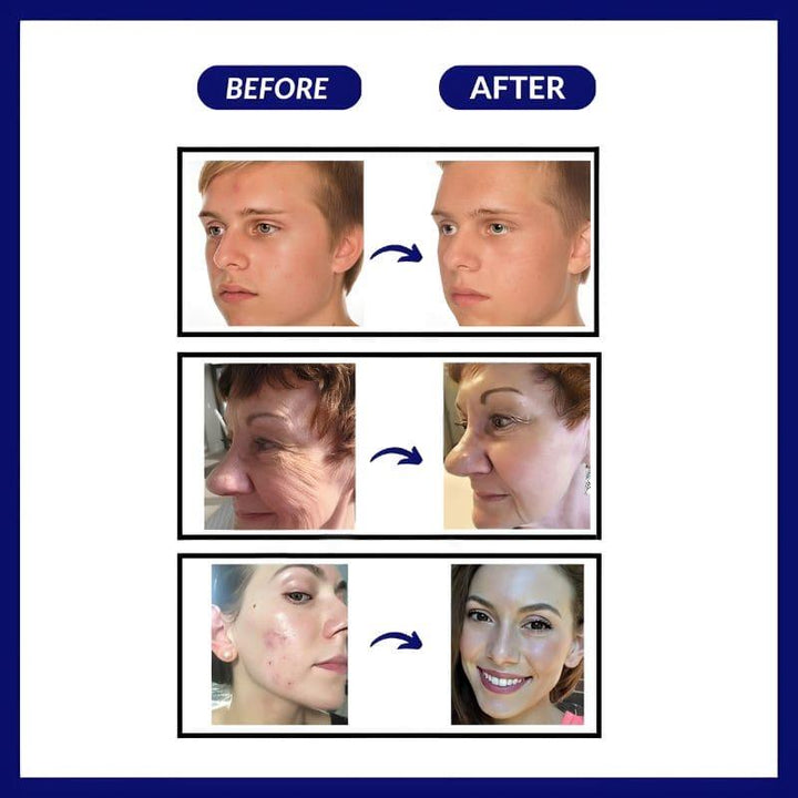 BowLift | LumièreRégénérante | Instant glow and well-being