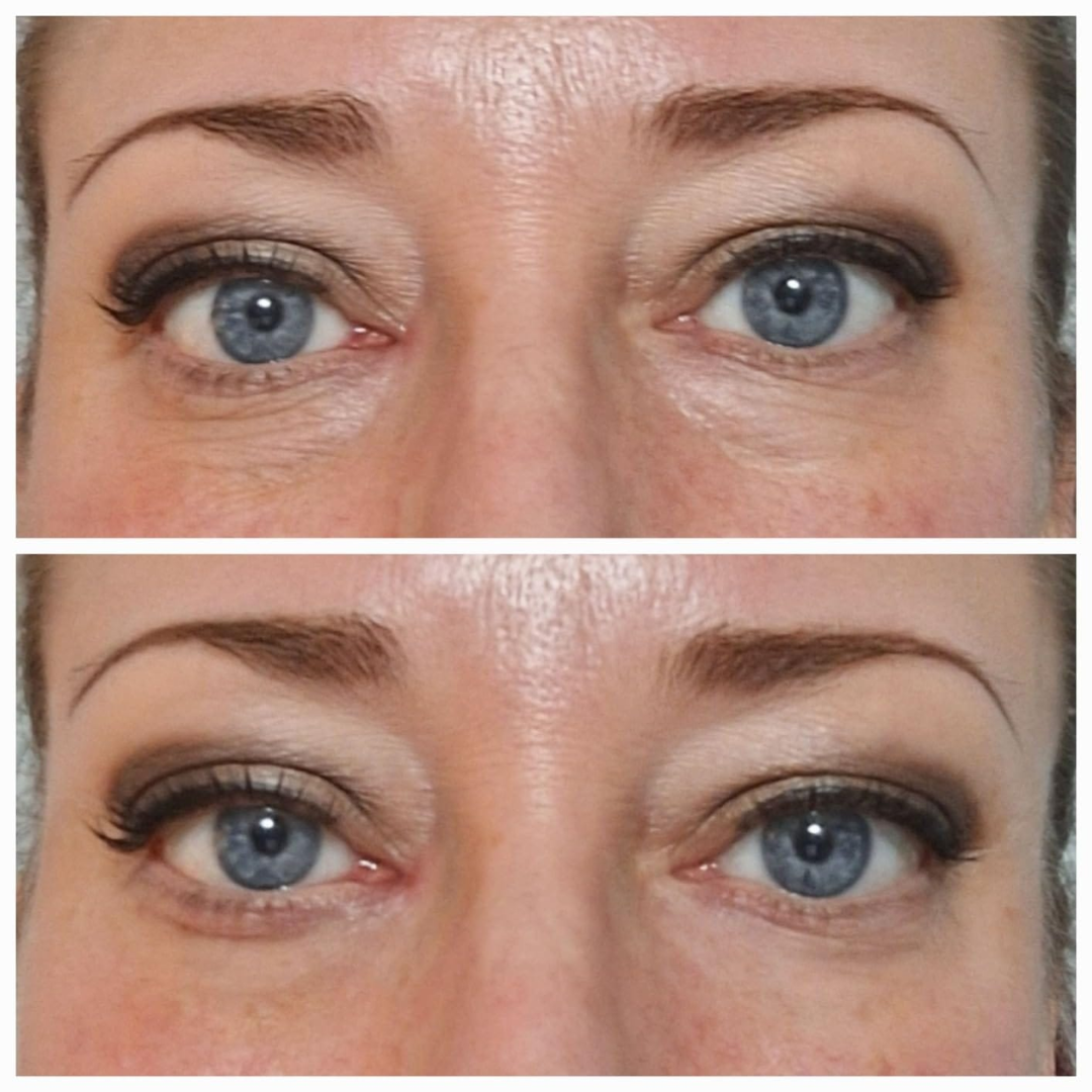 BowLift | VivaLuxe — Radiantly fresh look in seconds, effortlessly