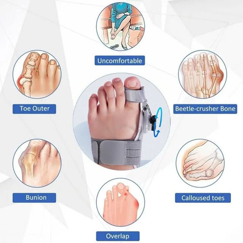 BowLift | Gentle toe correction for bunions