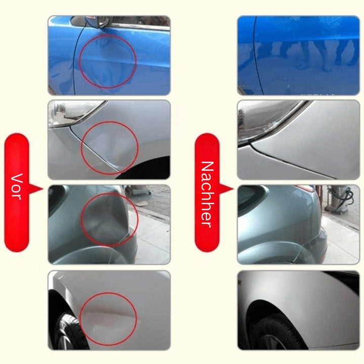 DeukFix Repair Set – Car Dents Removal Without Paint Damage | Bowlift