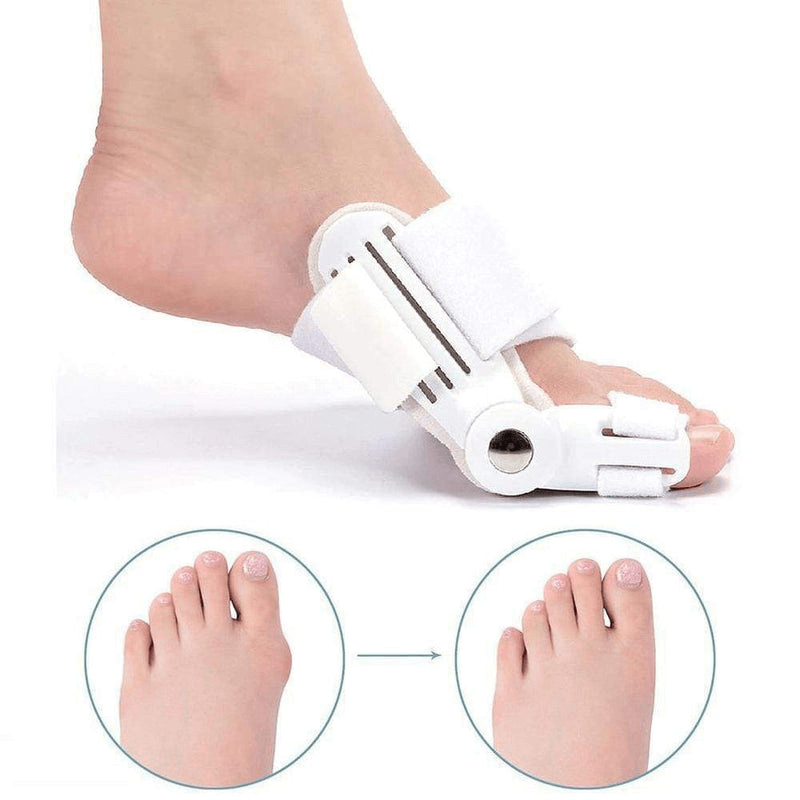 BowLift | Hallux Valgus Corrective Splint – Adjustable Orthotic for Bunion Relief