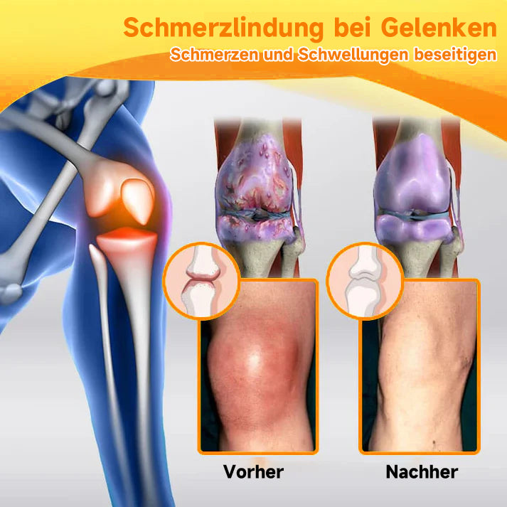 Bienen-Vital-Creme | Quick Pain Relief | Bowlift