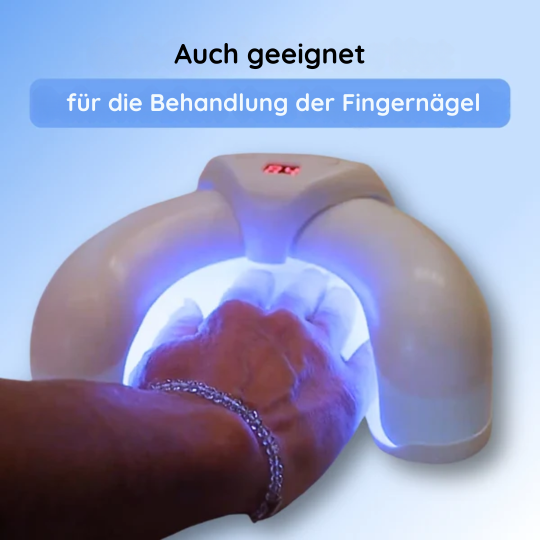 Nail therapy device | Home use, medication-free, nail fungus solution | Bowlift