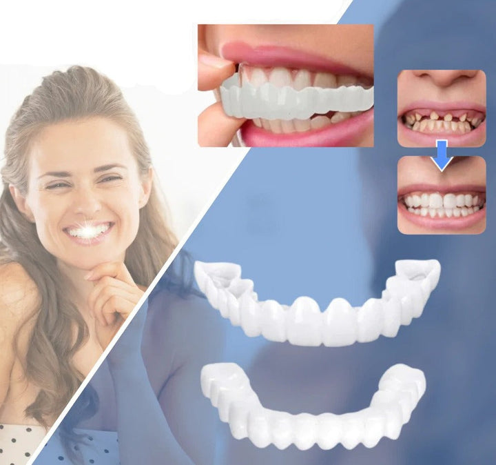 BowLift | Snap-on Teeth™ - With these veneers, always have the perfect smile