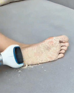 BowLift | USB Foot Callus Remover Pedicure Tool